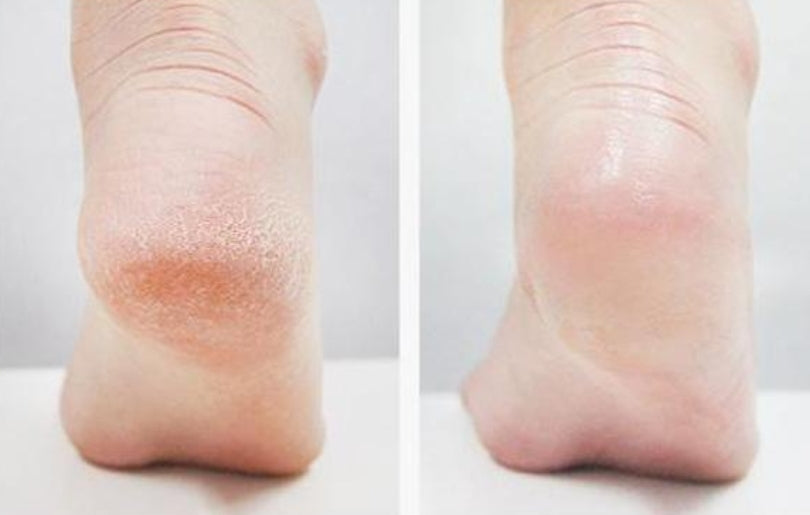 RiRe PIEDS HEEL CARE FOOT STICK